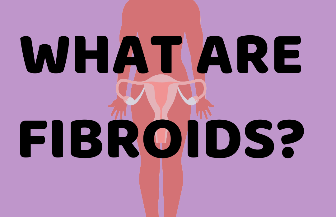 What Are Fibroids?